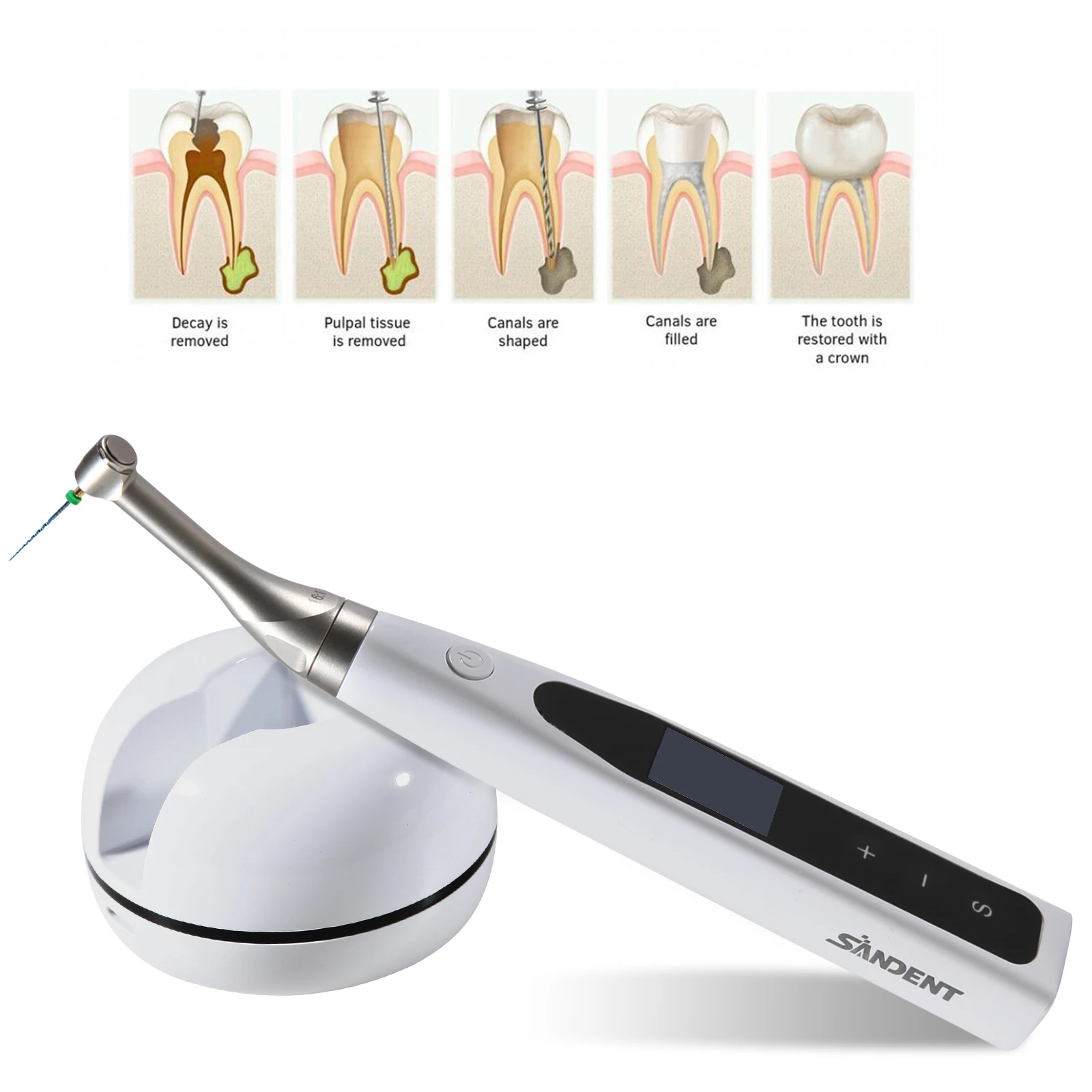 Motor Endo Dental ReciprocanteLED/No-LED 16:1 Endodoncia ​   Tratamiento del conducto radicular / Archivos NiTi