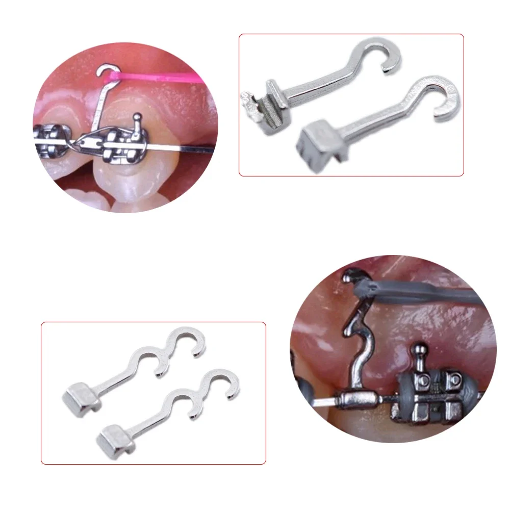 10 unidades de ganchos dentales de ortodoncia crimpables - Botón lingual, ganchos curvos largos con base de malla adherible, derecha/izquierda