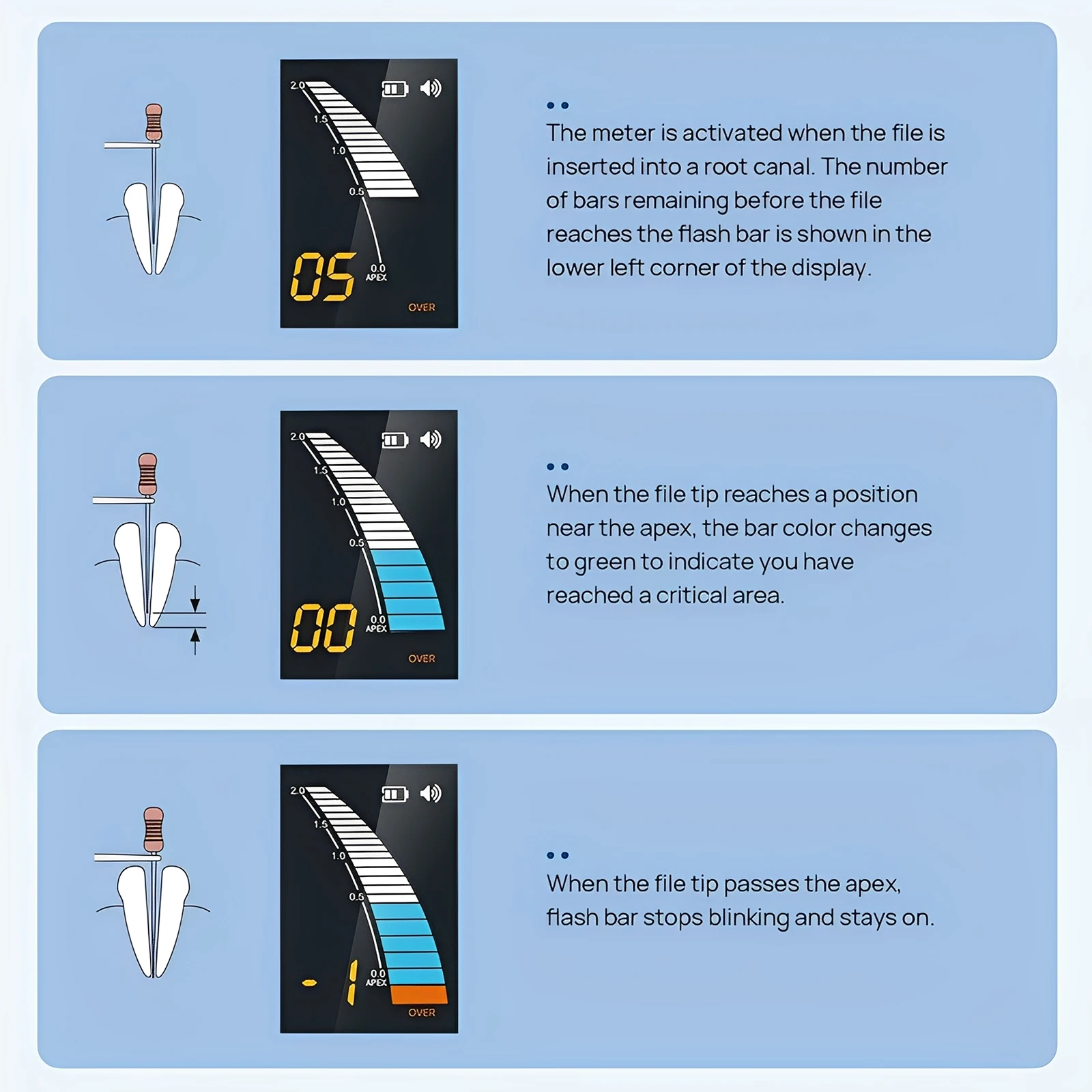 Localizador Dental LCD Endo Apex, Mini buscador de conducto radicular endodoncia, instrumentos de medida, estilo pájaro carpintero