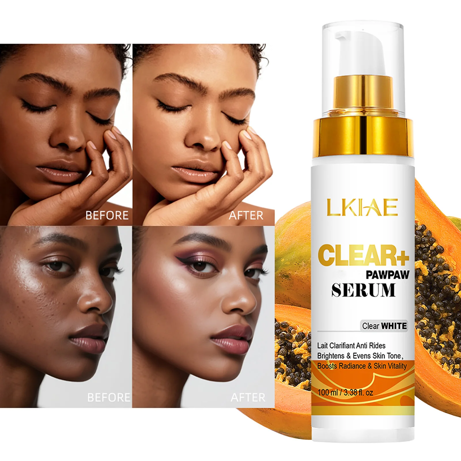 Crema Correctora de Manchas Oscuras AILKE PLUS, Crema Facial Orgánica para Corrección de Manchas Oscuras, Elimina Manchas, Manchas de la Edad, Manchas Solares