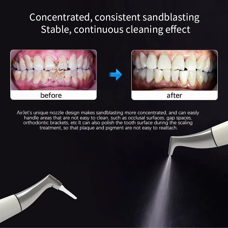 Pulidor Dental de Aire JUMTOP, Máquina de Blanqueamiento Dental con Chorro de Arena, 360 °   Pieza de mano giratoria libremente