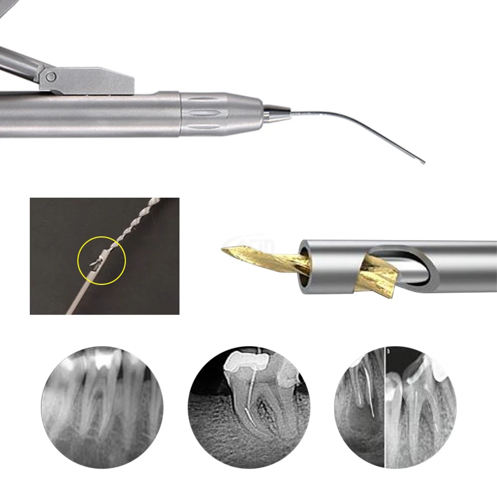 Extractor de archivos dentales, Kit de sistema de eliminación de archivos rotos, instrumento de terapia de archivos de conducto radicular, herramientas de endodoncia
