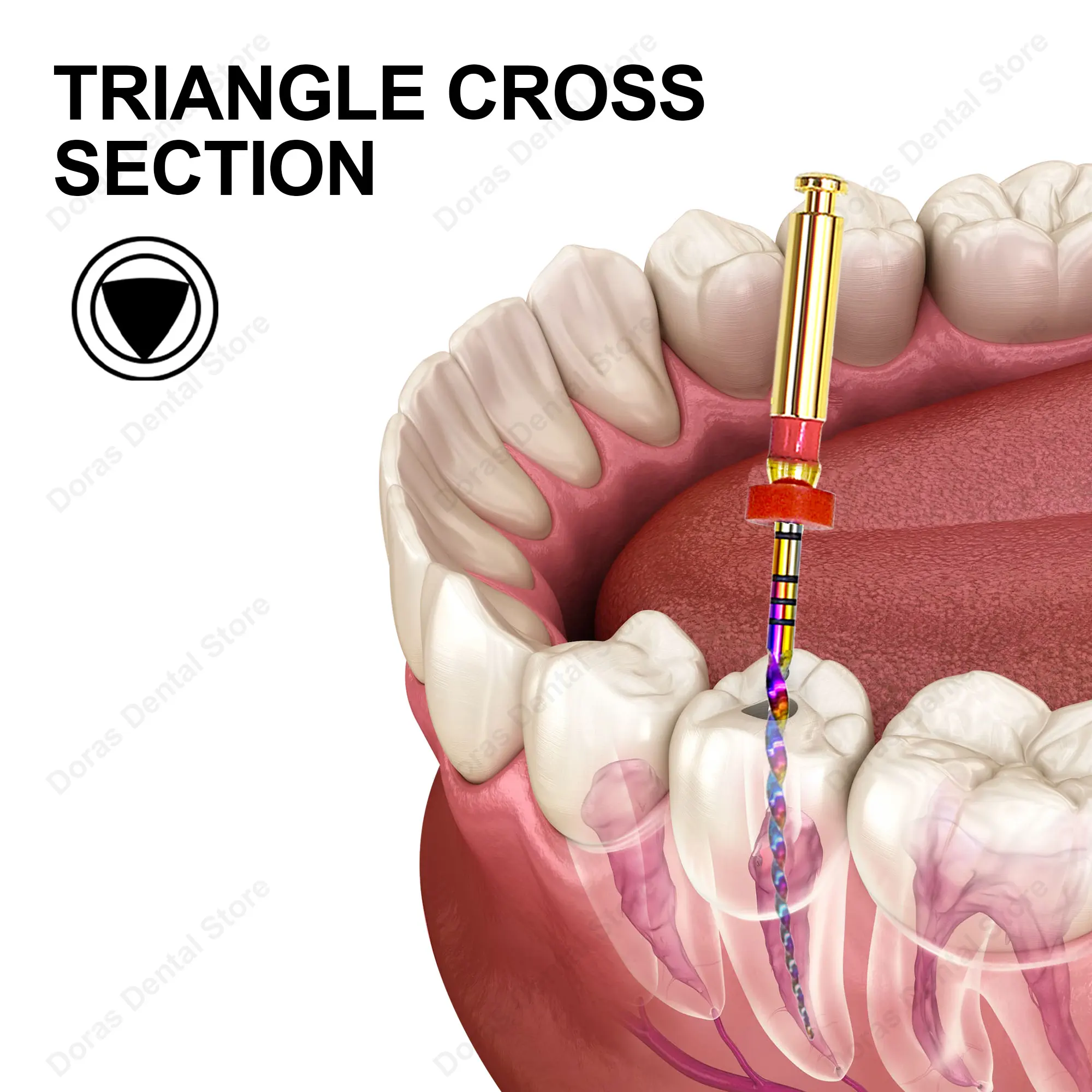 Sistema de limas dentales Glin Dental Rainbow, limas rotatorias superiores para endodoncia y conductos radiculares, modelo SX-F3, para uso odontológico, autoclavables, para la limpieza en odontología.