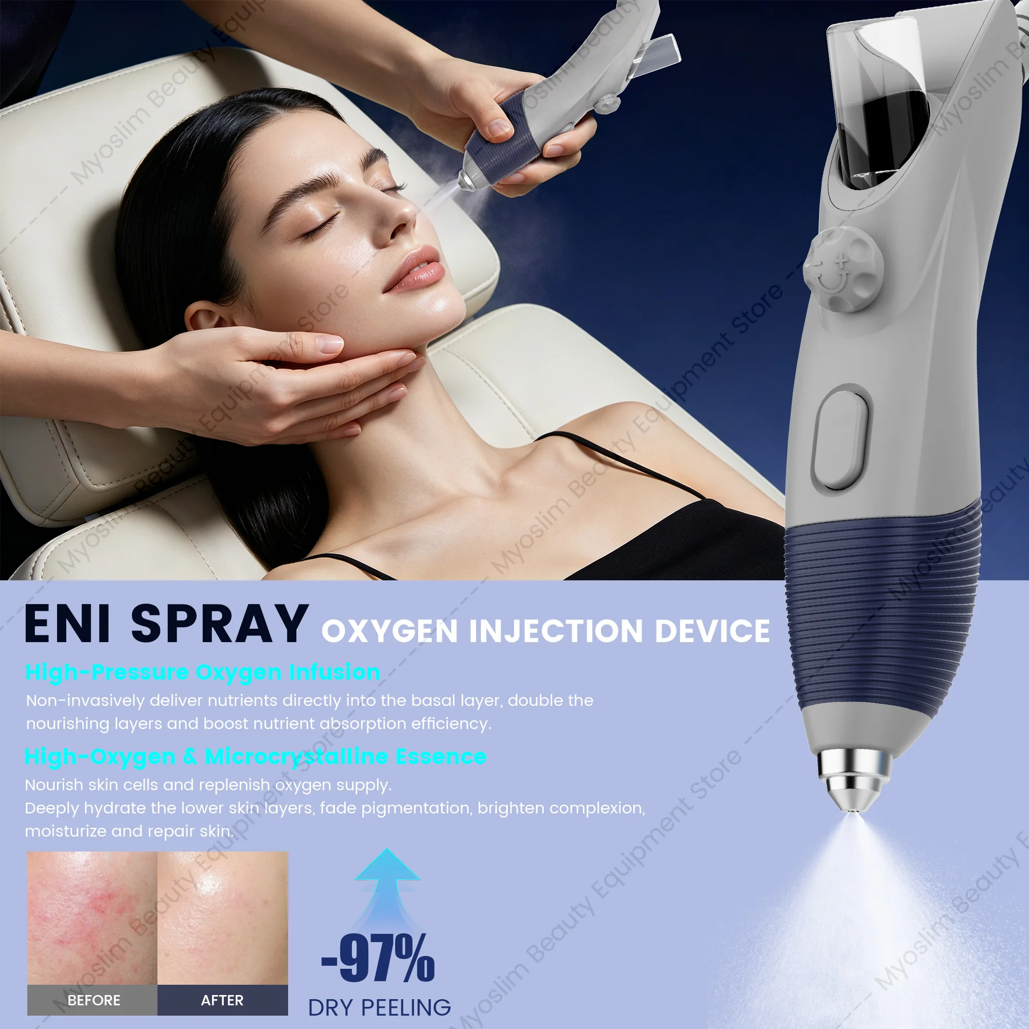 NUEVA Máquina de Gestión Facial M6 Hydri, Hidradermoabrasión, Limpieza Profunda, Lifting Facial, Equipo Profesional para Salón de Belleza